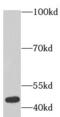 Actin Alpha 2, Smooth Muscle antibody, FNab00116, FineTest, Western Blot image 