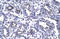 Forkhead Box P1 antibody, 27-635, ProSci, Enzyme Linked Immunosorbent Assay image 