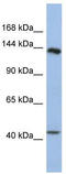 Slit Guidance Ligand 1 antibody, TA344212, Origene, Western Blot image 