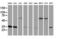 Cytochrome B5 Reductase 3 antibody, M03487, Boster Biological Technology, Western Blot image 