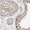 LanC Like 2 antibody, NBP1-83340, Novus Biologicals, Immunohistochemistry paraffin image 