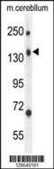 CD109 Molecule antibody, 55-303, ProSci, Western Blot image 