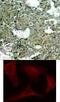 Mitogen-Activated Protein Kinase Kinase 1 antibody, 79-179, ProSci, Immunohistochemistry paraffin image 