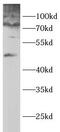 Glycogen Synthase 2 antibody, FNab10323, FineTest, Western Blot image 
