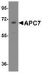 Anaphase-promoting complex subunit 7 antibody, A08839, Boster Biological Technology, Western Blot image 