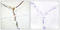 Aryl Hydrocarbon Receptor antibody, LS-C198601, Lifespan Biosciences, Immunohistochemistry frozen image 