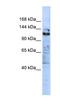 Zinc Finger Protein 451 antibody, NBP1-80330, Novus Biologicals, Western Blot image 