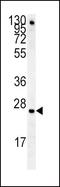 Insulin Like Growth Factor Binding Protein 4 antibody, PA5-25925, Invitrogen Antibodies, Western Blot image 