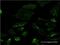 Spastin antibody, H00006683-M02, Novus Biologicals, Immunofluorescence image 