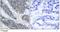 Insulin Receptor Substrate 1 antibody, GTX79034, GeneTex, Immunohistochemistry paraffin image 