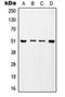 Transcriptional Adaptor 2A antibody, orb214641, Biorbyt, Western Blot image 