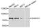 SAM And HD Domain Containing Deoxynucleoside Triphosphate Triphosphohydrolase 1 antibody, A7794, ABclonal Technology, Western Blot image 