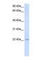 Transmembrane Protein 9 antibody, NBP1-69589, Novus Biologicals, Western Blot image 