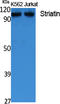 Striatin antibody, STJ96457, St John