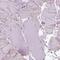 FAS antibody, HPA056108, Atlas Antibodies, Immunohistochemistry frozen image 
