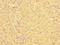 Kntc2 antibody, LS-C678782, Lifespan Biosciences, Immunohistochemistry paraffin image 