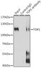 DNA Topoisomerase I antibody, GTX64445, GeneTex, Immunoprecipitation image 