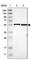 Nuclear Envelope Integral Membrane Protein 1 antibody, HPA014394, Atlas Antibodies, Western Blot image 