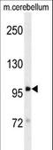 Discs Large MAGUK Scaffold Protein 4 antibody, LS-C167433, Lifespan Biosciences, Western Blot image 