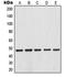 Inhibitor Of Nuclear Factor Kappa B Kinase Subunit Beta antibody, MBS820206, MyBioSource, Western Blot image 