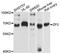 Zona Pellucida Glycoprotein 2 antibody, A10126, ABclonal Technology, Western Blot image 