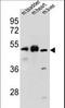 BTB Domain Containing 17 antibody, LS-C156876, Lifespan Biosciences, Western Blot image 