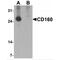 CD160 Molecule antibody, MBS153548, MyBioSource, Western Blot image 