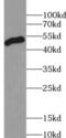 Zinc Finger FYVE-Type Containing 27 antibody, FNab09630, FineTest, Western Blot image 