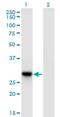 DnaJ Heat Shock Protein Family (Hsp40) Member C27 antibody, H00051277-M09, Novus Biologicals, Western Blot image 