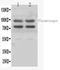 Plasminogen antibody, RP1027, Boster Biological Technology, Western Blot image 