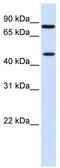 Zinc Finger Protein 710 antibody, TA339834, Origene, Western Blot image 