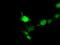 Doublecortin antibody, NBP2-03081, Novus Biologicals, Immunofluorescence image 