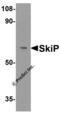 SPHK1 Interactor, AKAP Domain Containing antibody, 2261, ProSci, Western Blot image 
