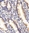 Ras-related protein Rab-35 antibody, A03845-1, Boster Biological Technology, Immunohistochemistry paraffin image 