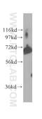 POF1B Actin Binding Protein antibody, 11398-1-AP, Proteintech Group, Western Blot image 