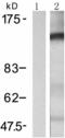 KIT antibody, TA323713, Origene, Western Blot image 