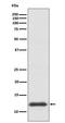 Thioredoxin antibody, M01219, Boster Biological Technology, Western Blot image 