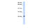 RAB18, Member RAS Oncogene Family antibody, ARP33116_P050, Aviva Systems Biology, Western Blot image 