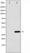 CCAAT Enhancer Binding Protein Alpha antibody, TA325355, Origene, Western Blot image 