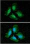 Protein Phosphatase 1 Catalytic Subunit Alpha antibody, NBP1-04334, Novus Biologicals, Immunocytochemistry image 
