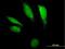 Deoxyribonuclease-2-alpha antibody, H00001777-B01P, Novus Biologicals, Immunocytochemistry image 