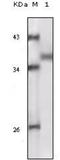 Ribosomal Protein S6 Kinase A1 antibody, NBP1-47405, Novus Biologicals, Western Blot image 