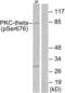 Protein Kinase C Theta antibody, LS-C117459, Lifespan Biosciences, Western Blot image 