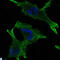 Junction Plakoglobin antibody, LS-C812522, Lifespan Biosciences, Immunohistochemistry paraffin image 