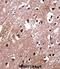 LIM Domain Binding 2 antibody, abx028011, Abbexa, Immunohistochemistry frozen image 