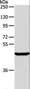 AlkB Homolog 1, Histone H2A Dioxygenase antibody, LS-C401143, Lifespan Biosciences, Western Blot image 