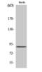 Patatin Like Phospholipase Domain Containing 8 antibody, PA5-50992, Invitrogen Antibodies, Western Blot image 