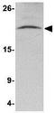 Nanos C2HC-Type Zinc Finger 3 antibody, GTX85389, GeneTex, Western Blot image 