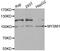 Histone H2A deubiquitinase MYSM1 antibody, MBS2517112, MyBioSource, Western Blot image 