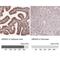 High Mobility Group Nucleosomal Binding Domain 3 antibody, NBP2-62640, Novus Biologicals, Immunohistochemistry paraffin image 